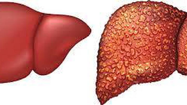 if-you-love-your-liver-and-want-to-live-long-avoid-excessive-intake-of-these-3-things
